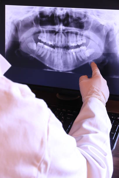 Best Emergency Care for Gum Disease in North Shore, CA