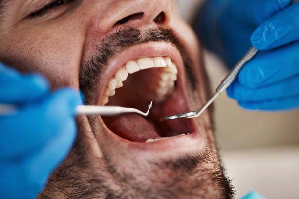Best Emergency Treatment for Jaw Pain or Injury in North Shore, CA